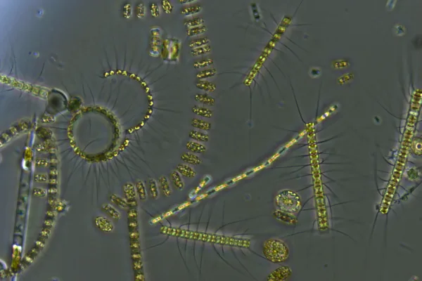 wikimedia billede fra University of Rhode Island/Stephanie Anderson af fytoplanktonet