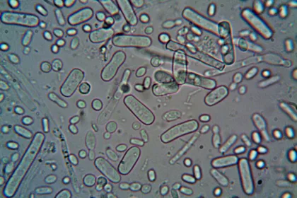 pexels.com foto af turek: mikrober