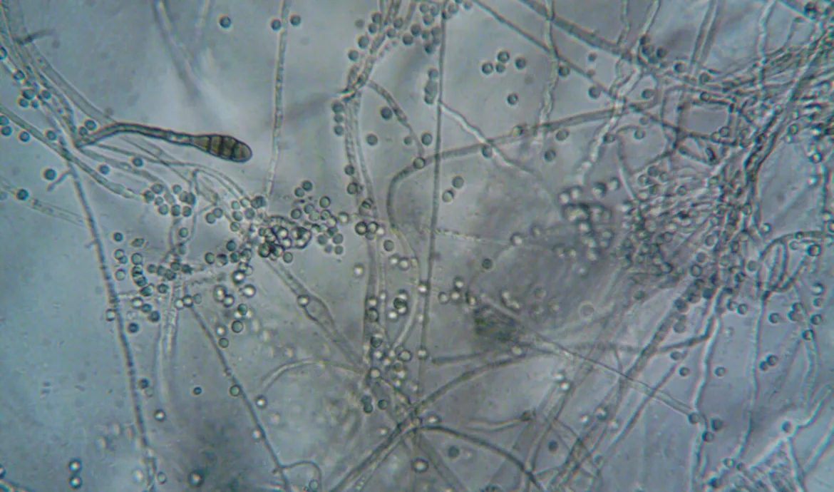 pexels.com foto af turek: mikrober