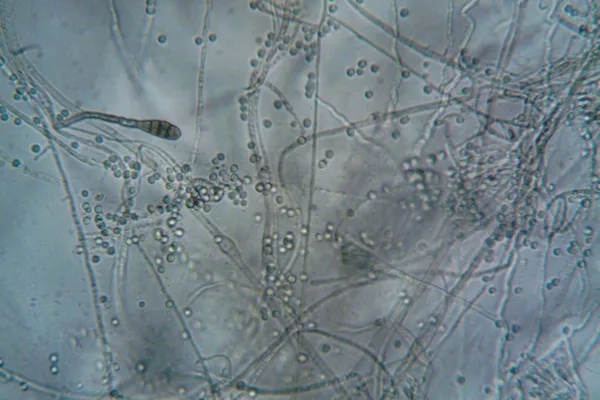 pexels.com foto af turek: mikrober